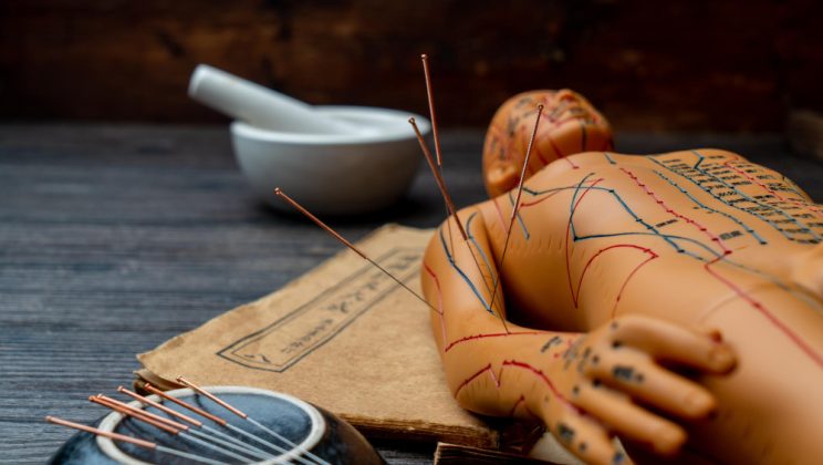 Cum acupunctura poate reduce durerea și îmbunătăți starea generală